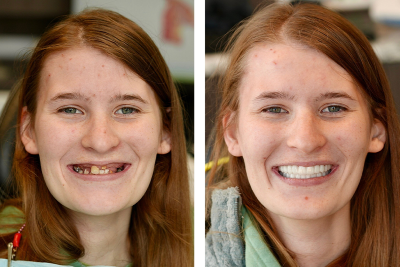 patient before and after image
