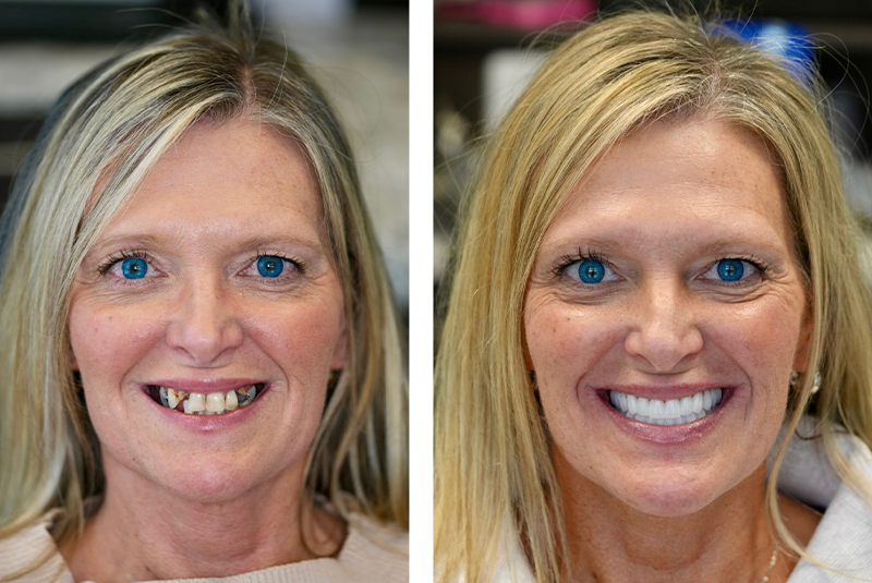 patient before and after image