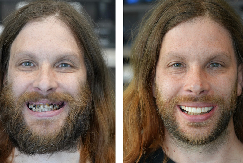 patient before and after image