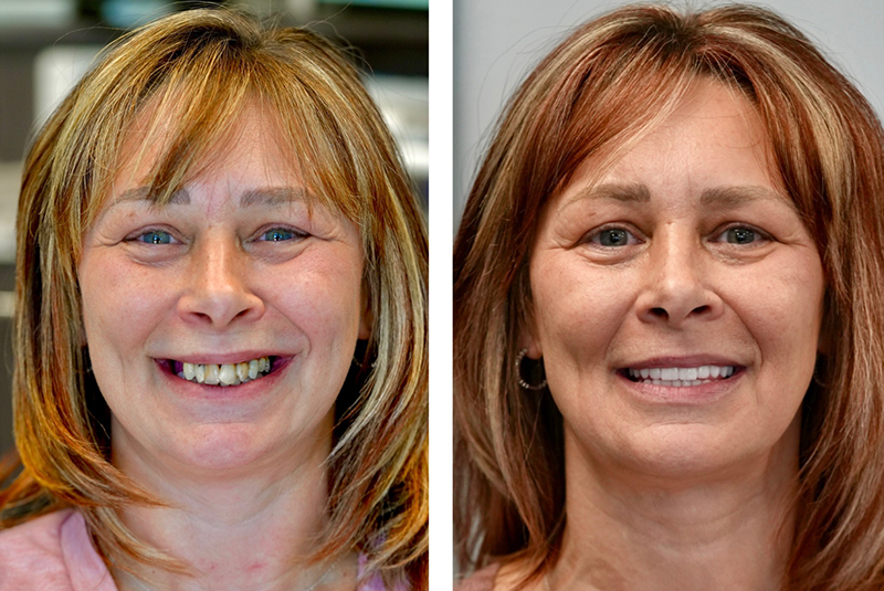 patient before and after image