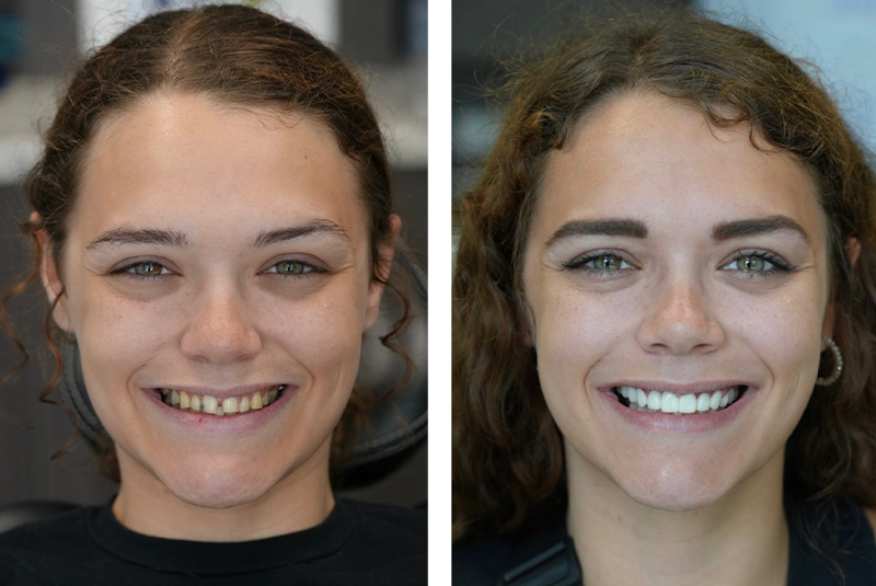 patient before and after image