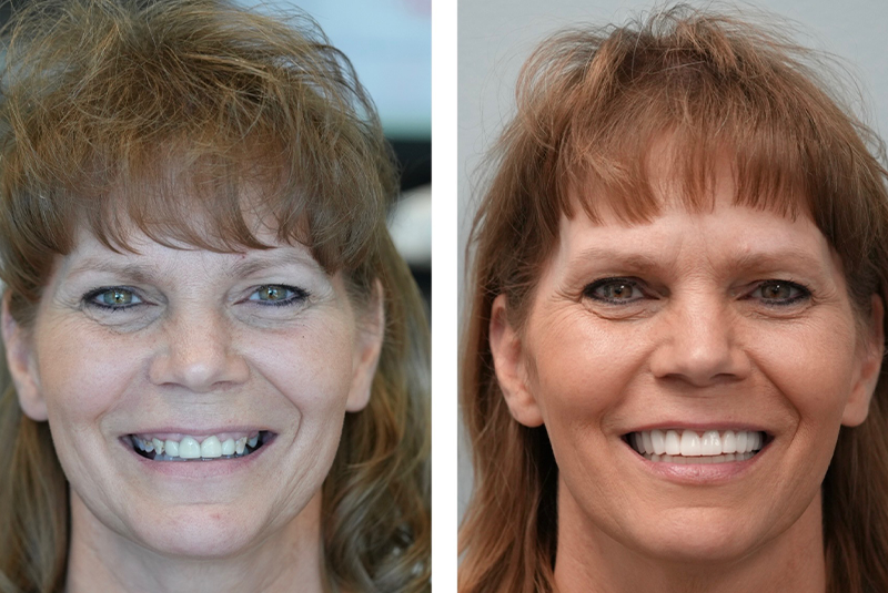 patient before and after image